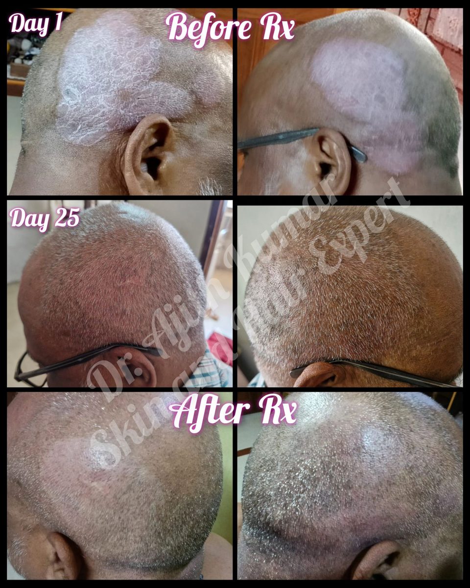 Holistic Skin & Hair Expert in Udupi - Skin Care Result