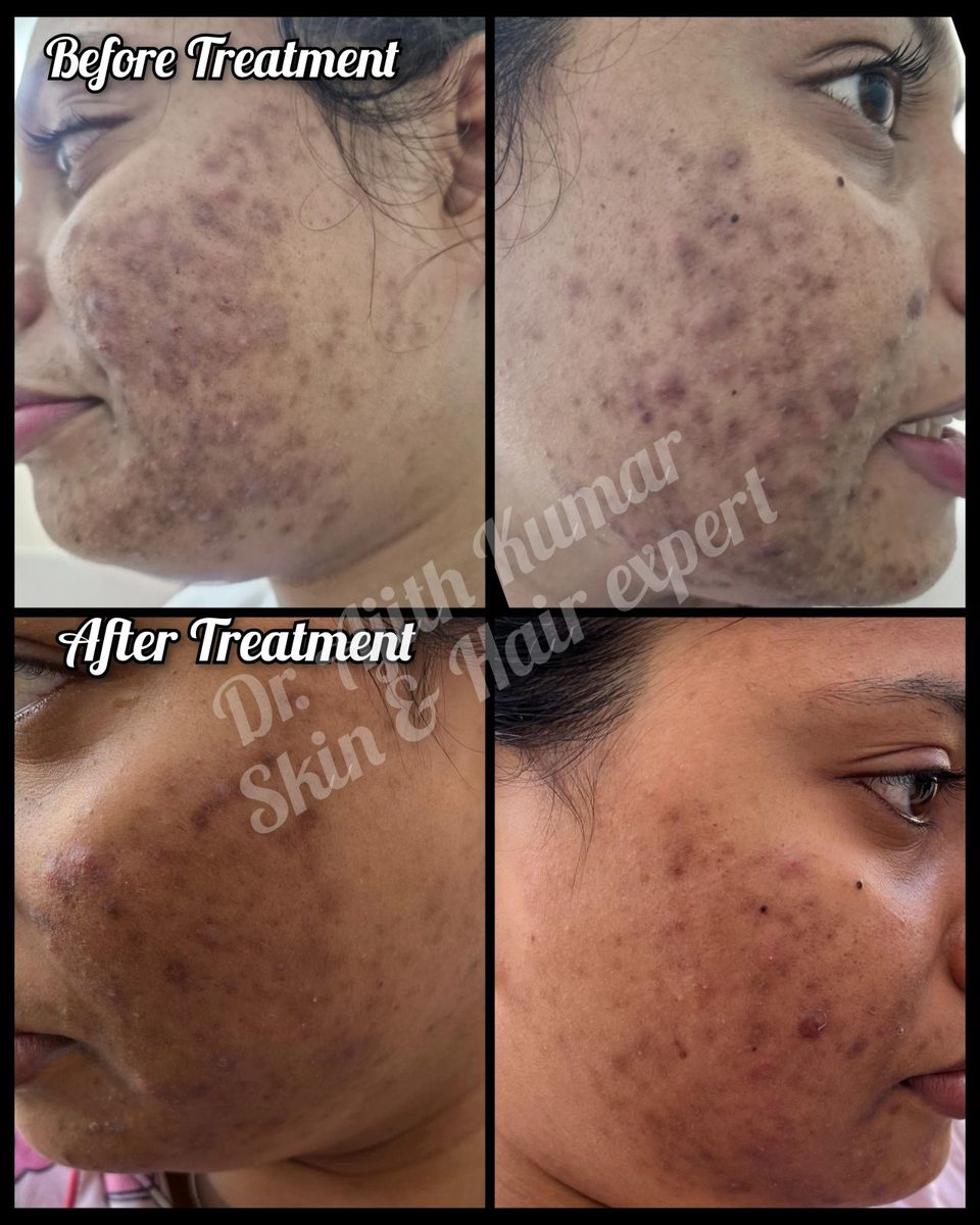 Holistic Skin and Hair Expert Udupi - Clear Skin Journey