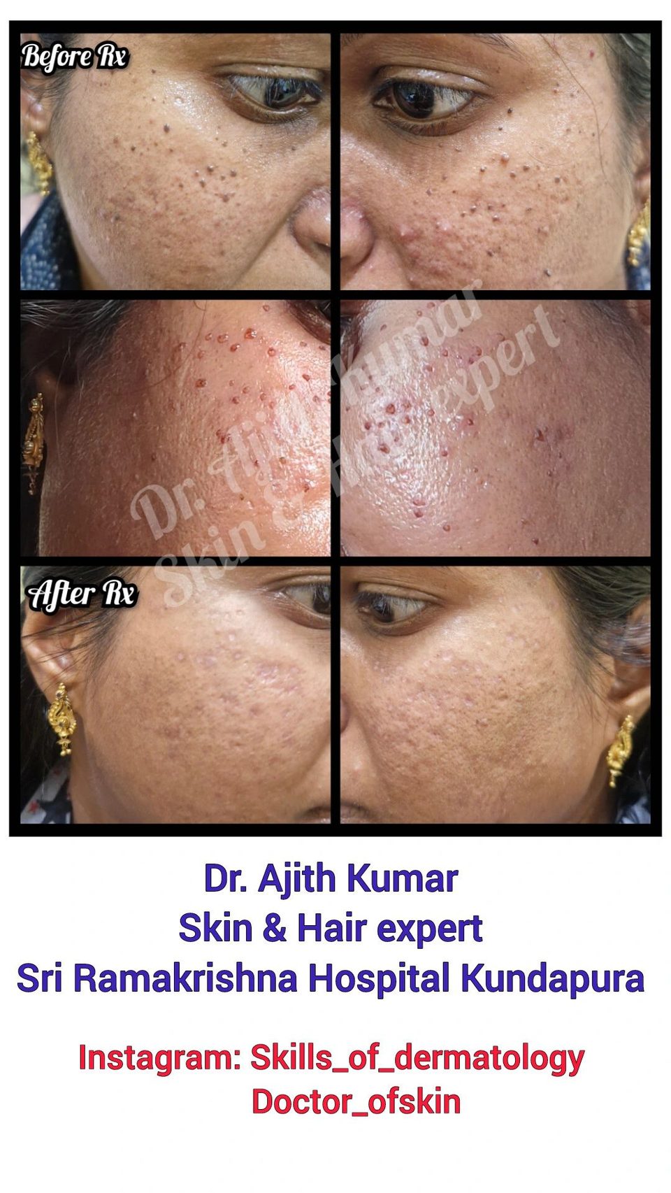 Holistic Skin and Hair Expert in Udupi - Treatment Result